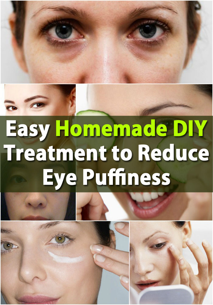 Easy Homemade DIY Treatment to Reduce Eye Puffiness