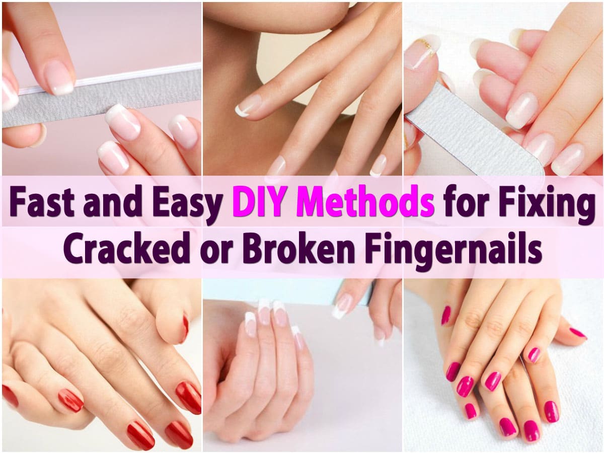 Fast and Easy DIY Methods for Fixing Cracked or Broken Fingernails - DIY &  Crafts