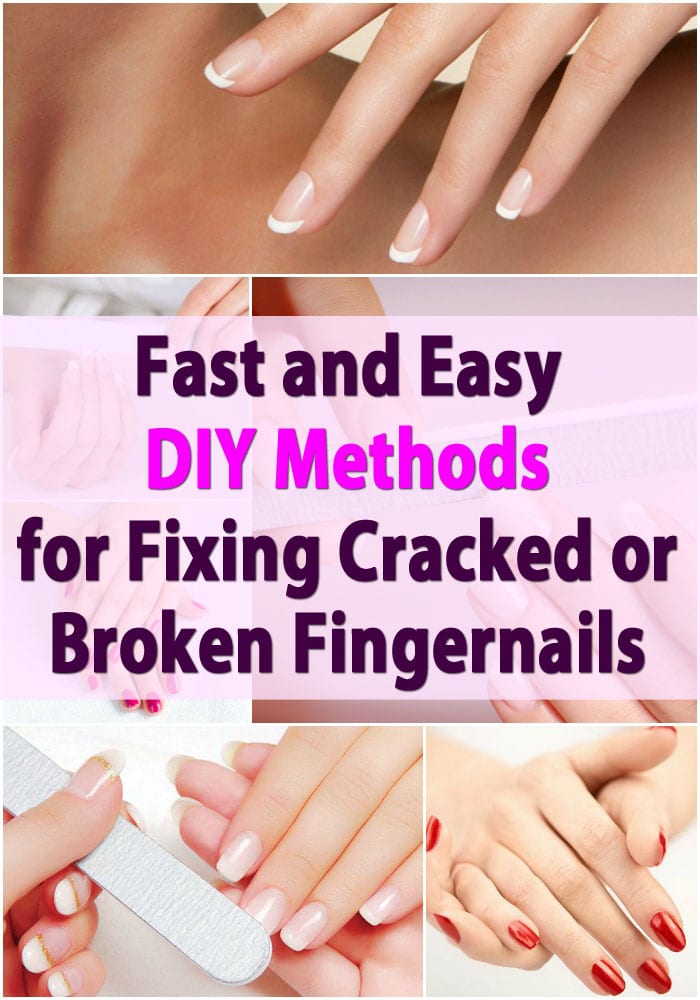 Fast and Easy DIY Methods for Fixing Cracked or Broken Fingernails