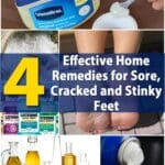 4 Effective Home Remedies for Sore, Cracked and Stinky Feet pinterest image.
