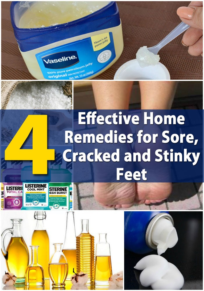 4 Effective Home Remedies For Sore Cracked And Stinky Feet Diy Crafts