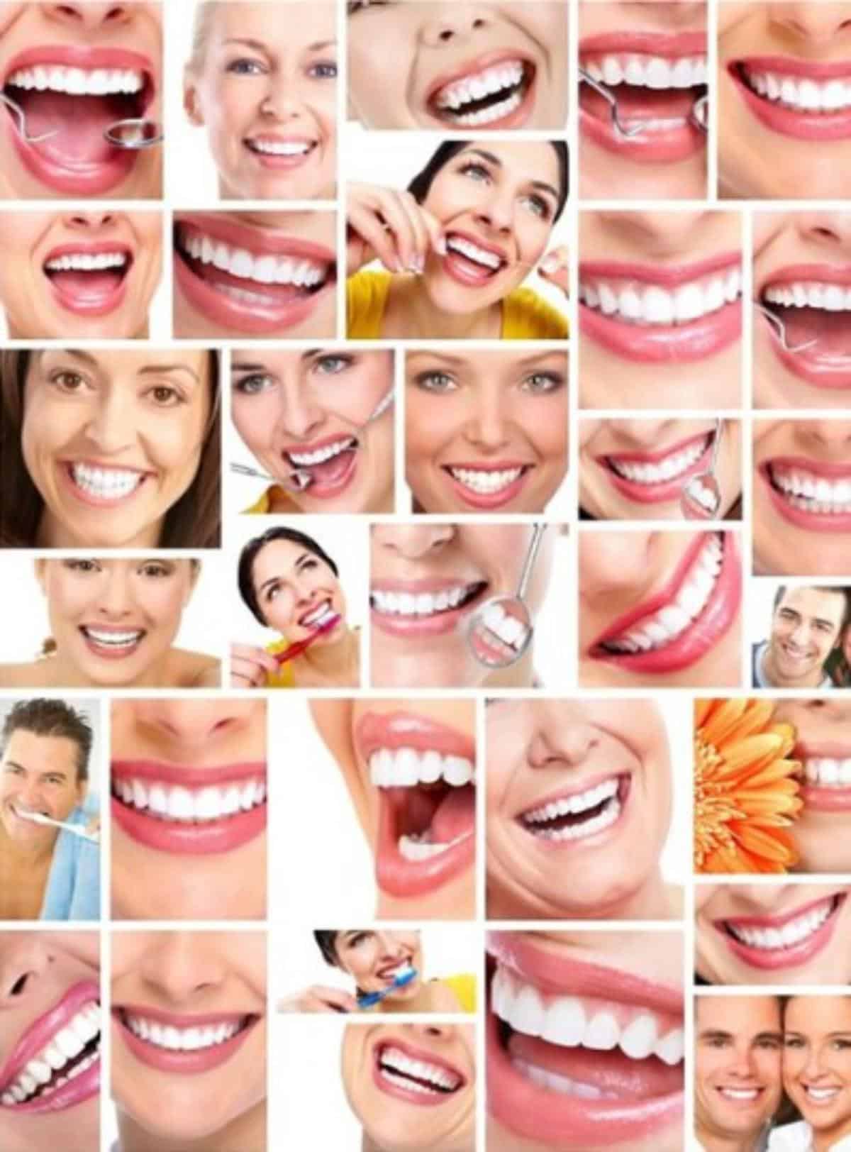 Collage of smiles