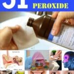51 Extraordinary Everyday Uses for Hydrogen Peroxide pinterest image.