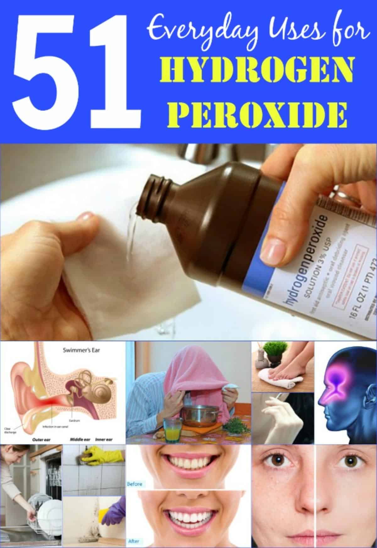 51 Extraordinary Everyday Uses for Hydrogen Peroxide pinterest image.