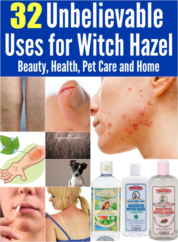 32 Unbelievable Uses for Witch Hazel: Beauty, Health, Pet Care and Home...