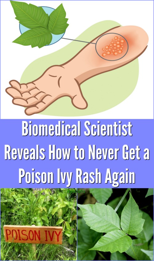 Biomedical Scientist Reveal How to Never Get a Poison Ivy Rash Again {Video}